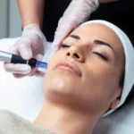 HIDRATACION LABIOS DERMAPEN