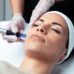 DERMA